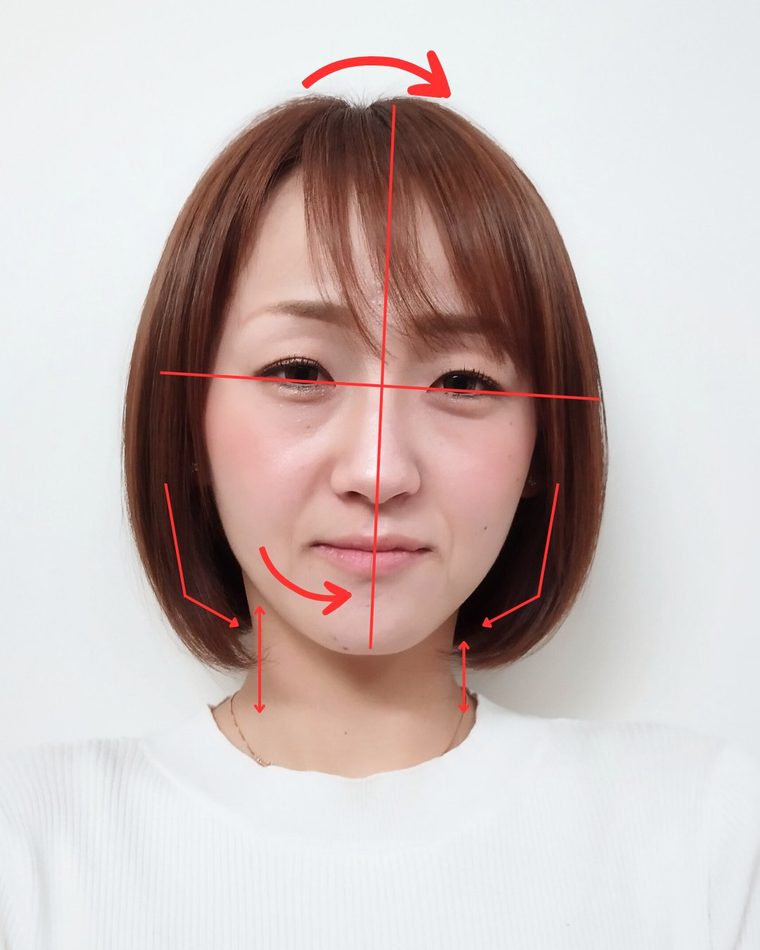 CASE 01 出産を機に顔が変わってきた 顔の歪み解析｜ゆうき式小顔矯正