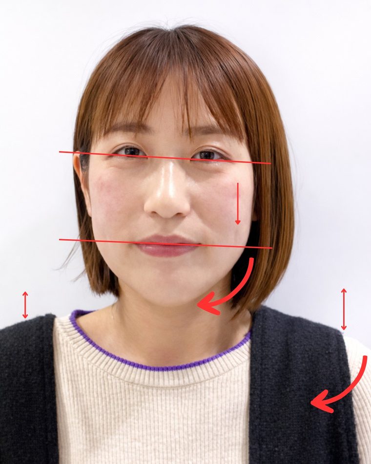 CASE 04 年齢と共に顔が変化してきた 顔の歪み解析｜ゆうき式小顔矯正